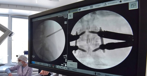 В Оренбурге научились удалять грыжи позвоночника через крошечный прокол