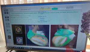 Испытано на себе: обследование за 30 минут в областном центре медпрофилактики