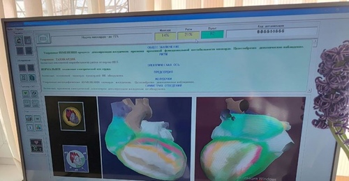 Испытано на себе: обследование за 30 минут в областном центре медпрофилактики