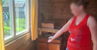 В Абдулино местная жительница получила перелом челюсти после встречи со знакомой
