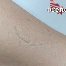 Инстинкт предков: жительница Бугурусланского района покусала полицейского